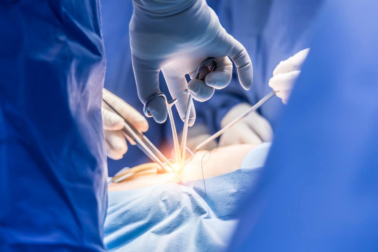 CARDIAC PROCEDURES